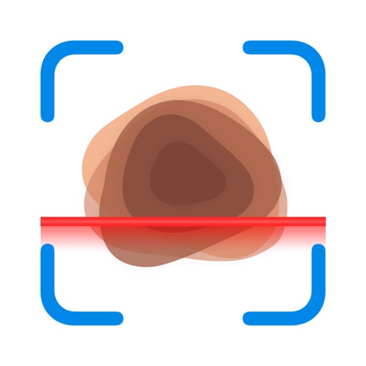 Mole Checker & Scanner: DermAi IPA v1.5.16 (Features unlocked) For iOS