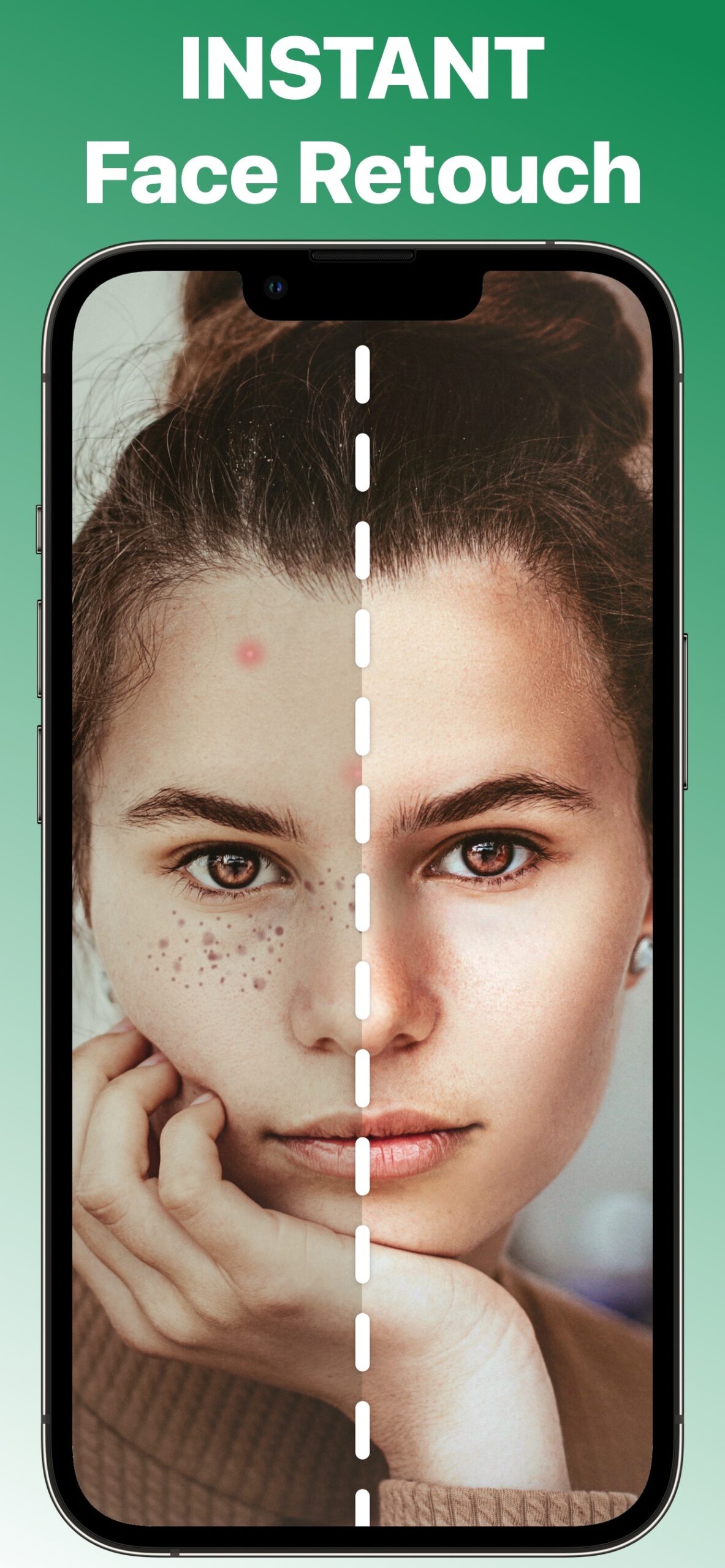 Blemish Remover Face Retouch screenshot 1
