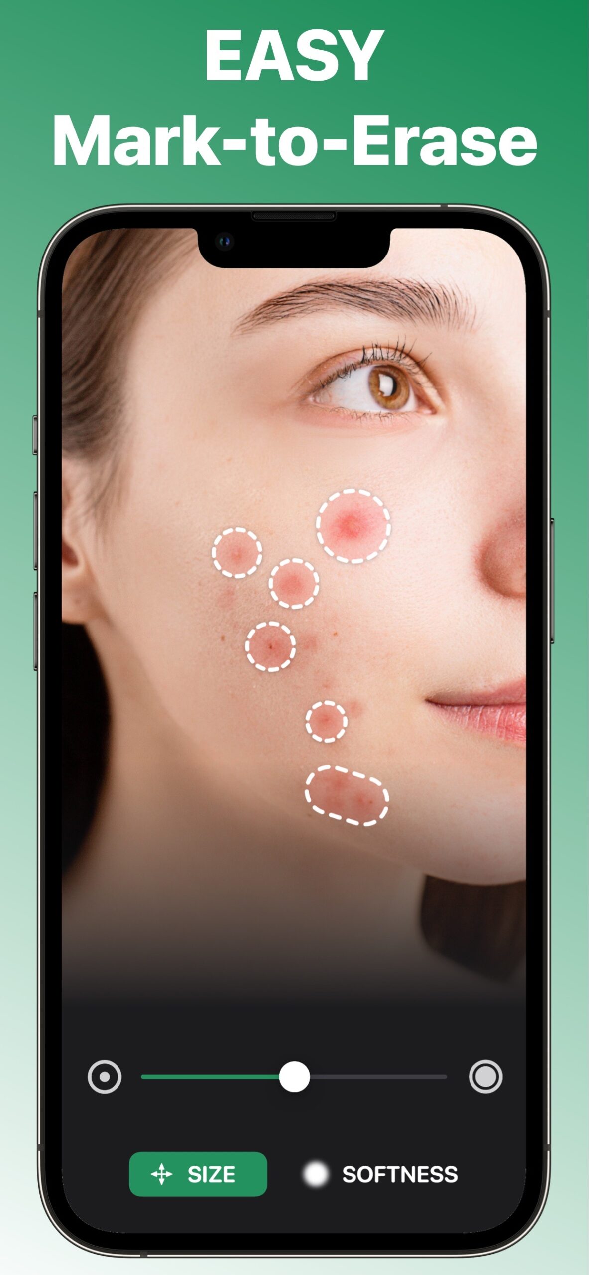 Blemish Remover Face Retouch screenshot 2