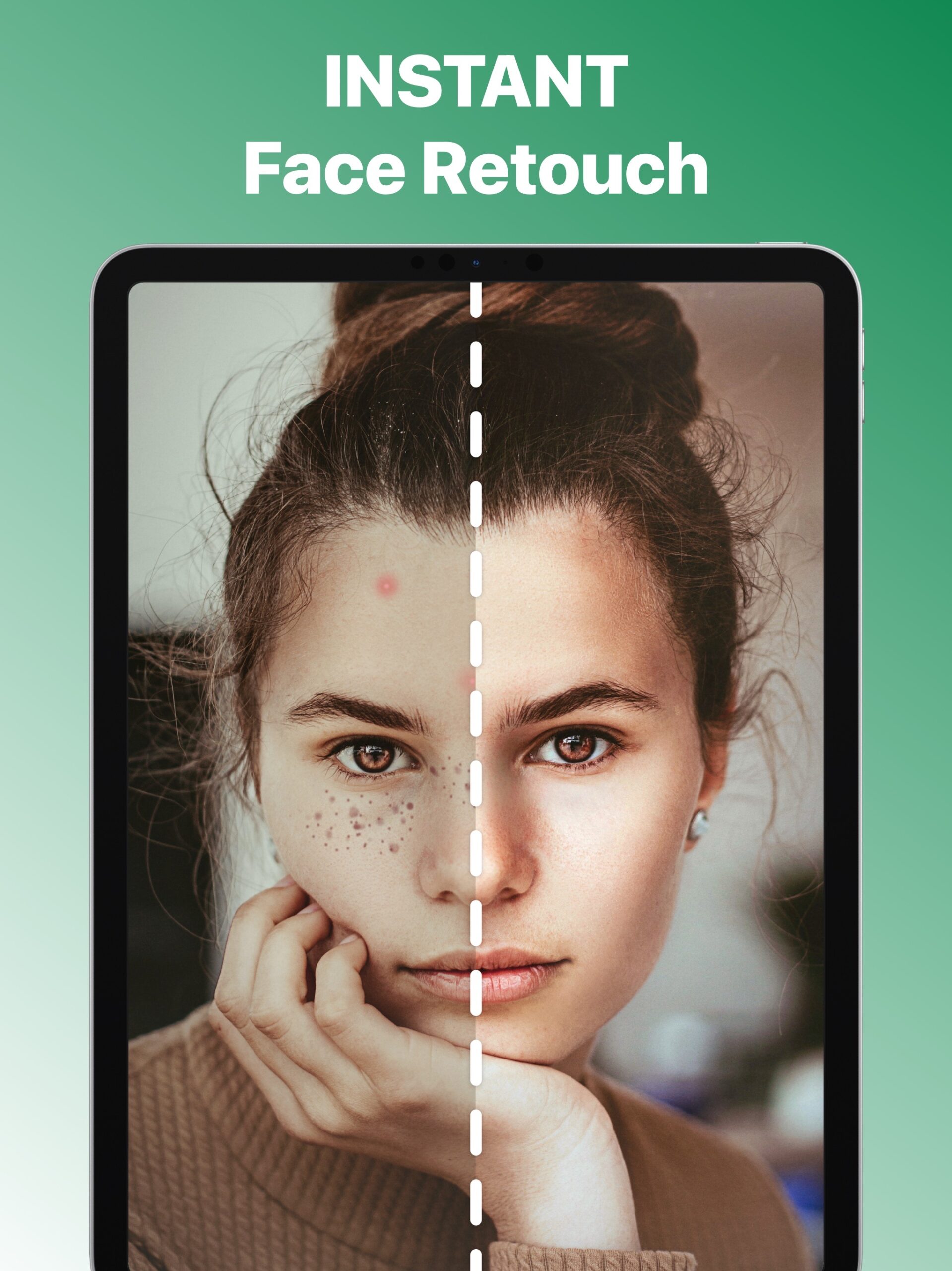 Blemish Remover Face Retouch screenshot 5