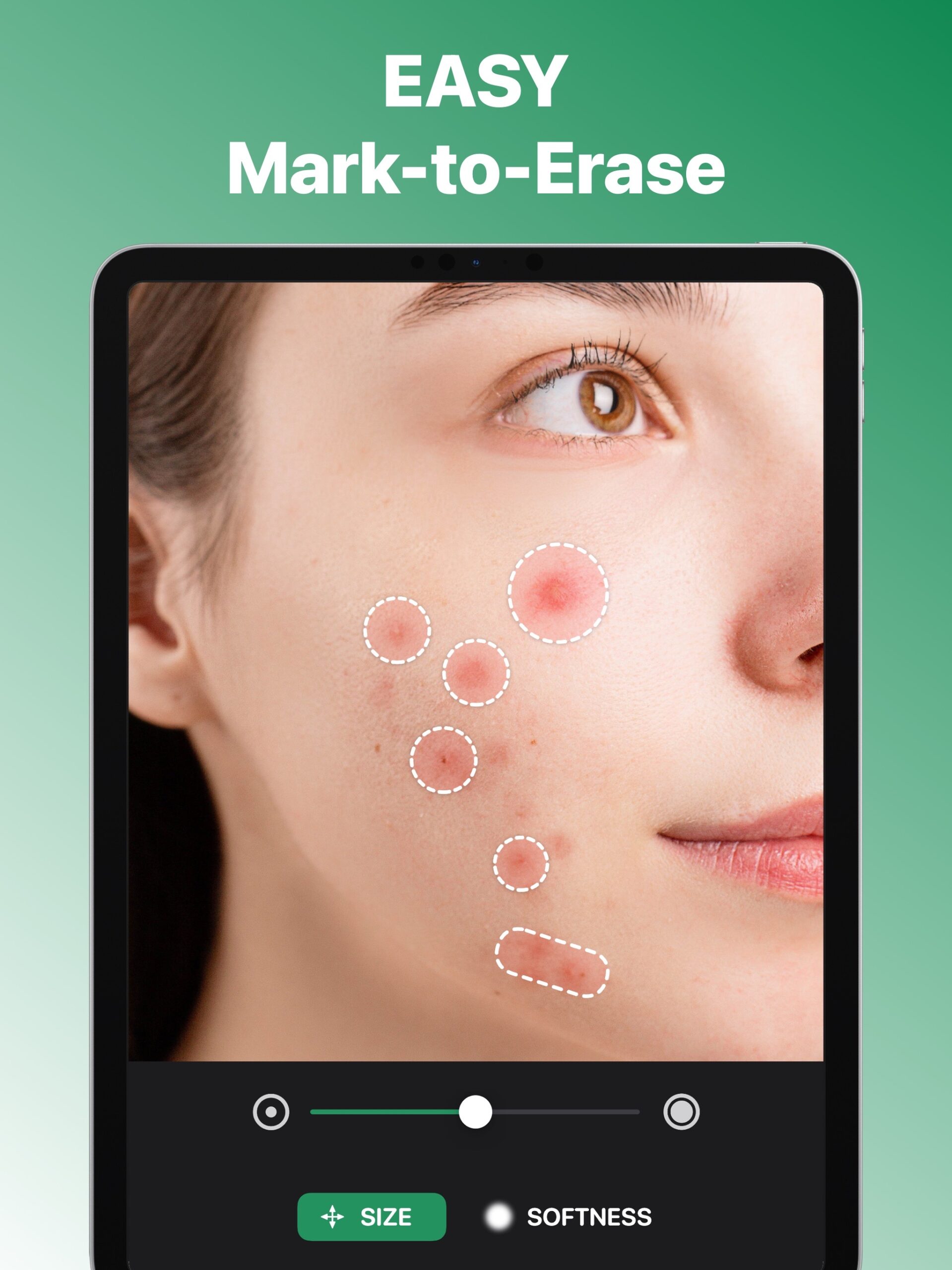 Blemish Remover Face Retouch screenshot 6